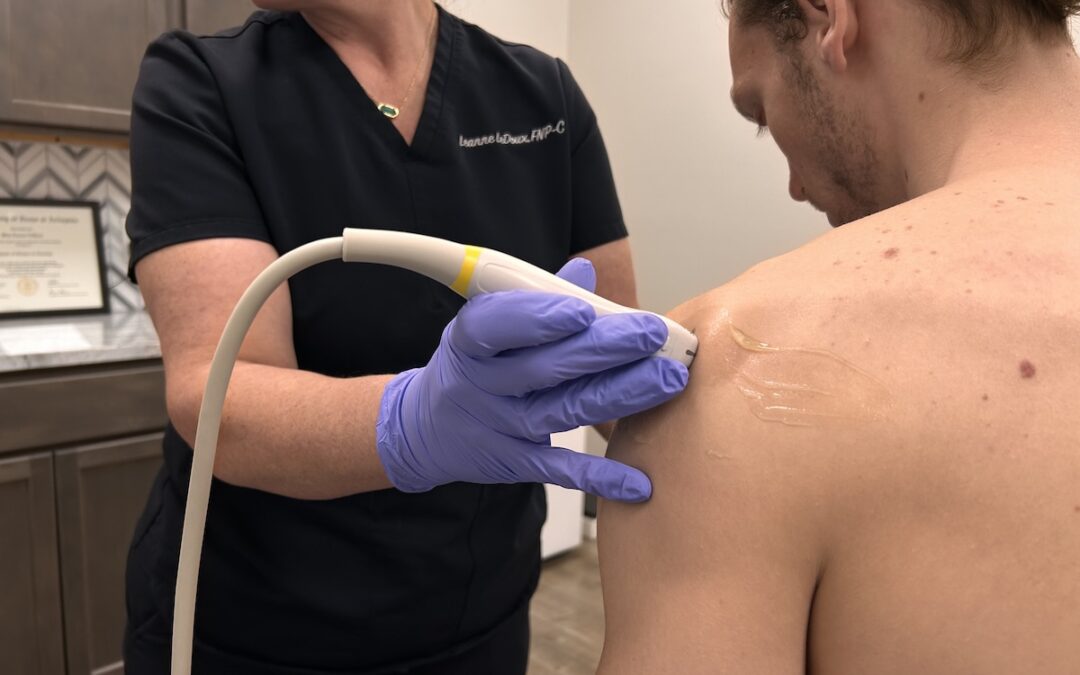 A female nurse performing an ultrasound on a male patient's shoulder before a stem cell injection in Waco, TX.